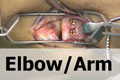 VJ Ortho orthopaedic surgery educational video - elbow and arm