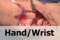 VJ Ortho orthopaedic surgery educational video - hand and wrist
