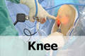 VJ Ortho orthopaedic surgery educational video - knee