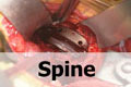 VJ Ortho orthopaedic surgery educational video - spine